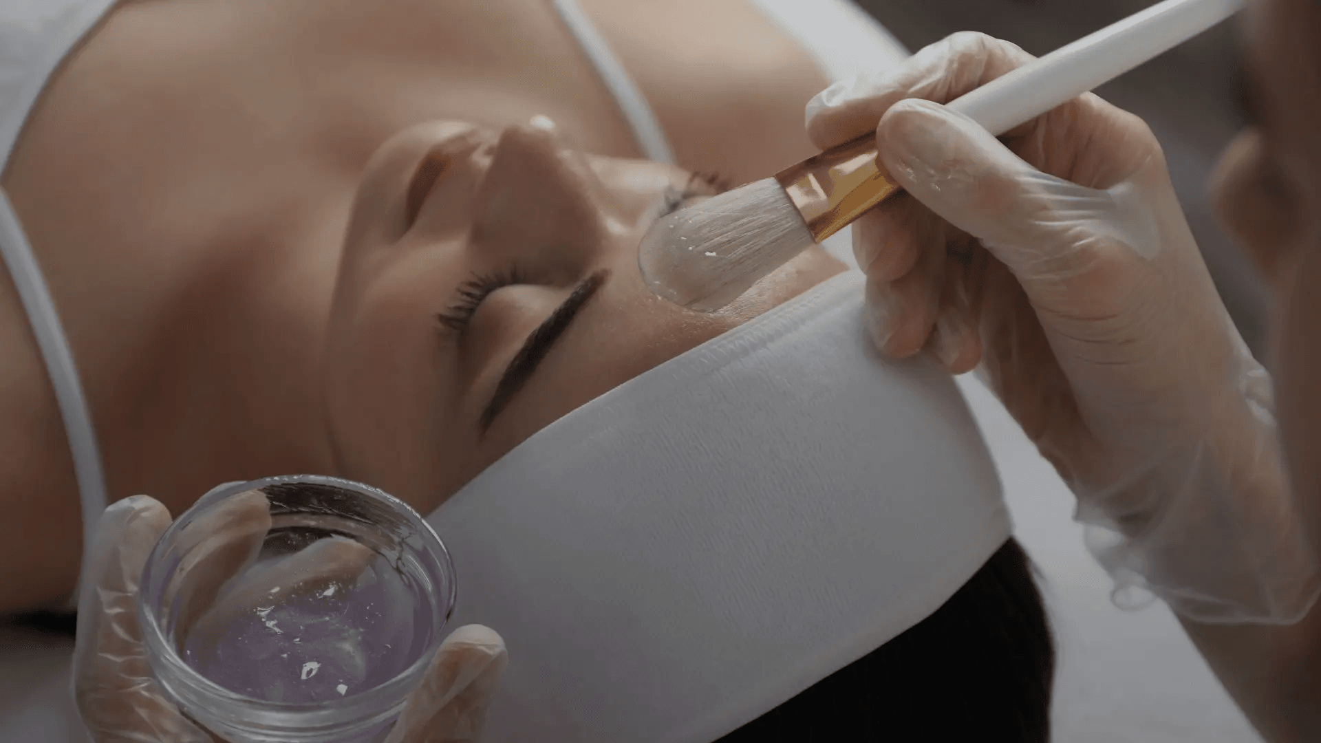 Chemical Peel Treatment